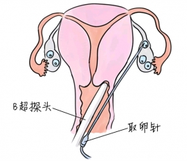 孕检正常 为何迟迟怀不上孩子呢